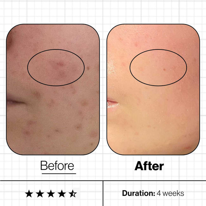 Advanced Nutrition Skin Clear Biome  - 60 capsuals